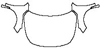 Nissan Altima (US) SR 2023 - Hood+Fender (with Splash Guards)