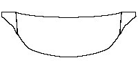 Buick Regal Sedan 2018 - Hood+Fender (One third of Hood + Fender)