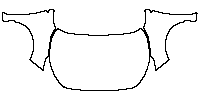 Subaru Impreza (US) Sport 2024 - Hood+Fender